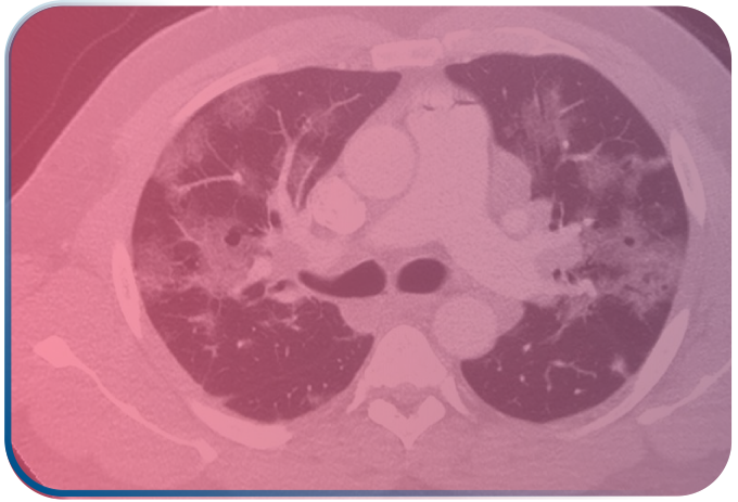 128 Slice CT Scan