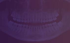 Digital OPG & Cephalometry for Dental Imaging